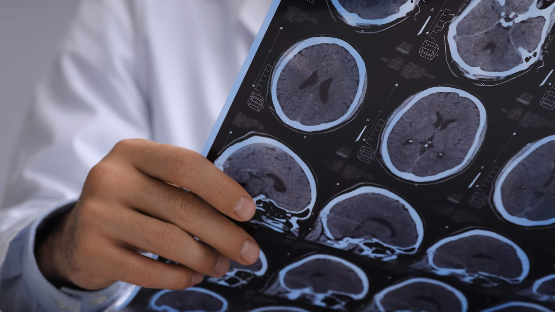doctor reviewing x-rays of a person's brain